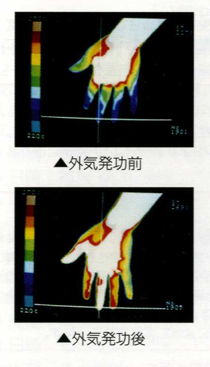 気功による手の温度の変化
