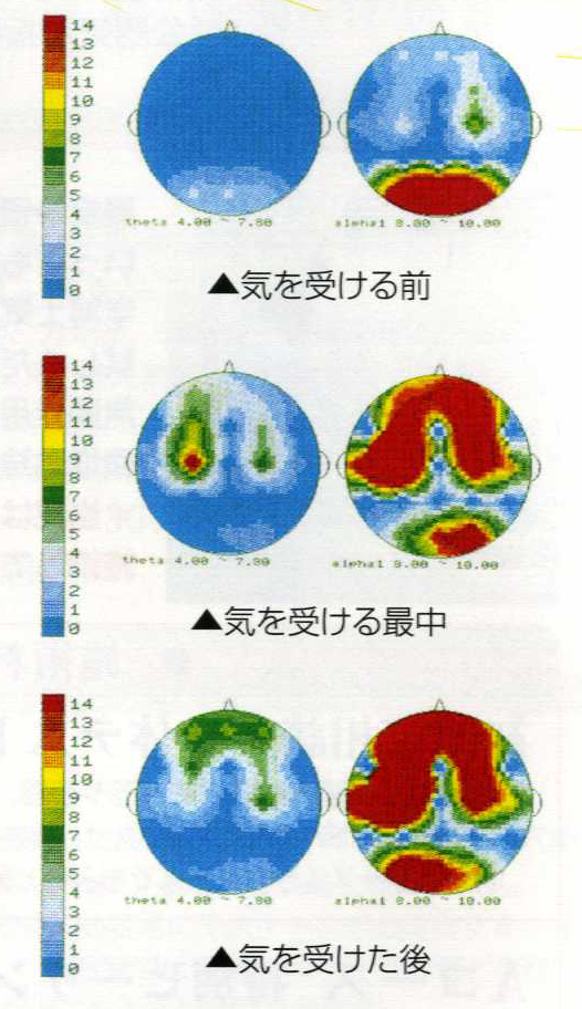 気功による脳波の変化具合